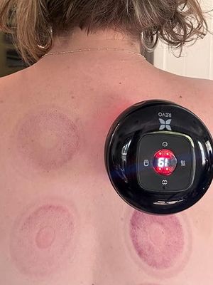 Stop paying for Overpriced cupping when you can do it at home!