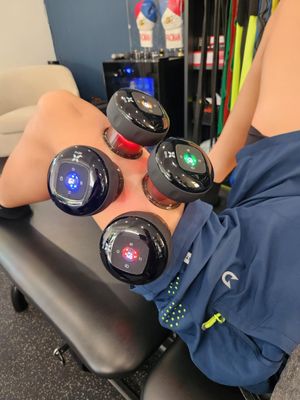 A new era of cupping