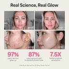 Woman using REVO Face Genie LED device on cheek