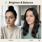 REVO Face Genie clear skin before and after graphic