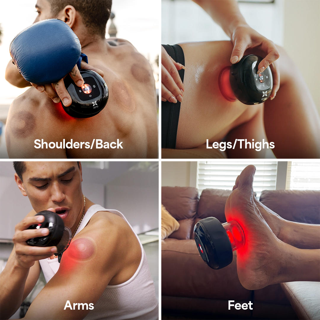 REVO Smart Cupping Massager used on shoulders back legs and arms